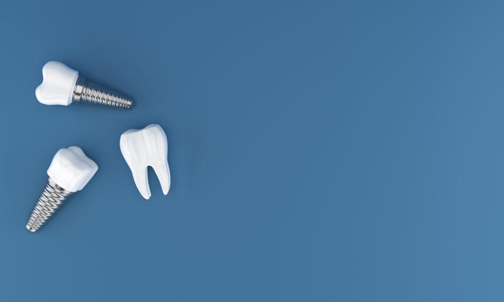 dental-implants-surgery-3d-rendering