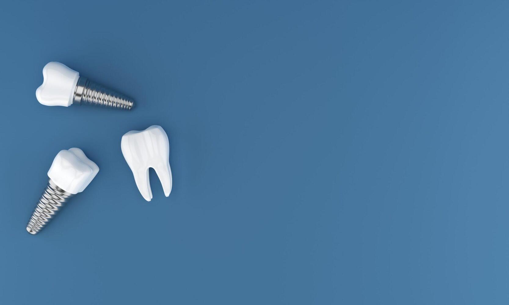 Best Dental Implants Near Me | Gentle Family Dentistry