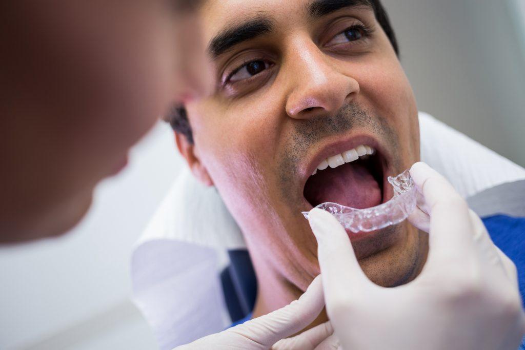 Dentist assisting a patient to wear orthodontic silicone invisible braces