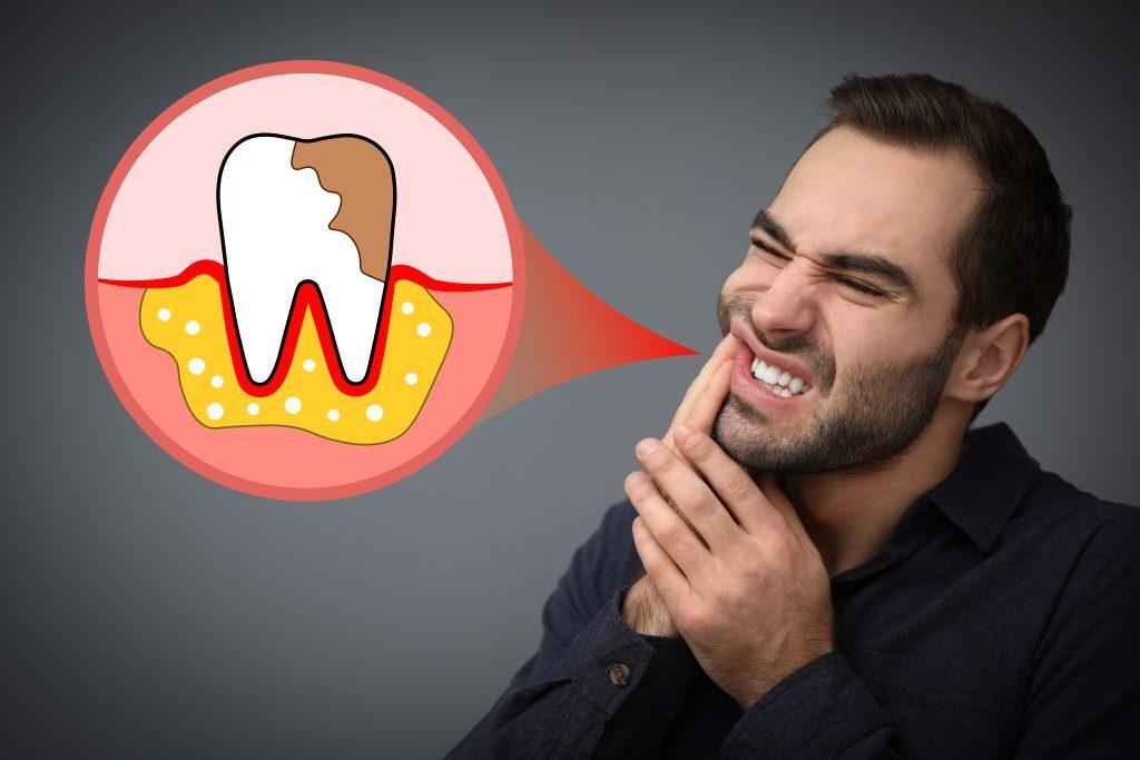 Young man suffering from strong tooth pain on grey background, s