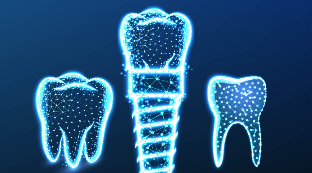Restore Your Smile with Dental Crowns in High Point