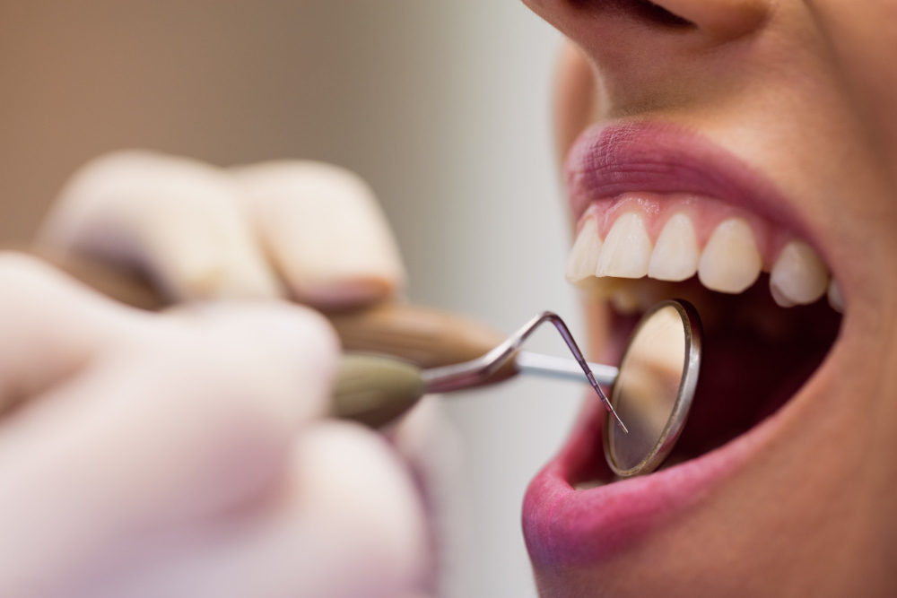 The Benefits of Invisalign in Highpoint