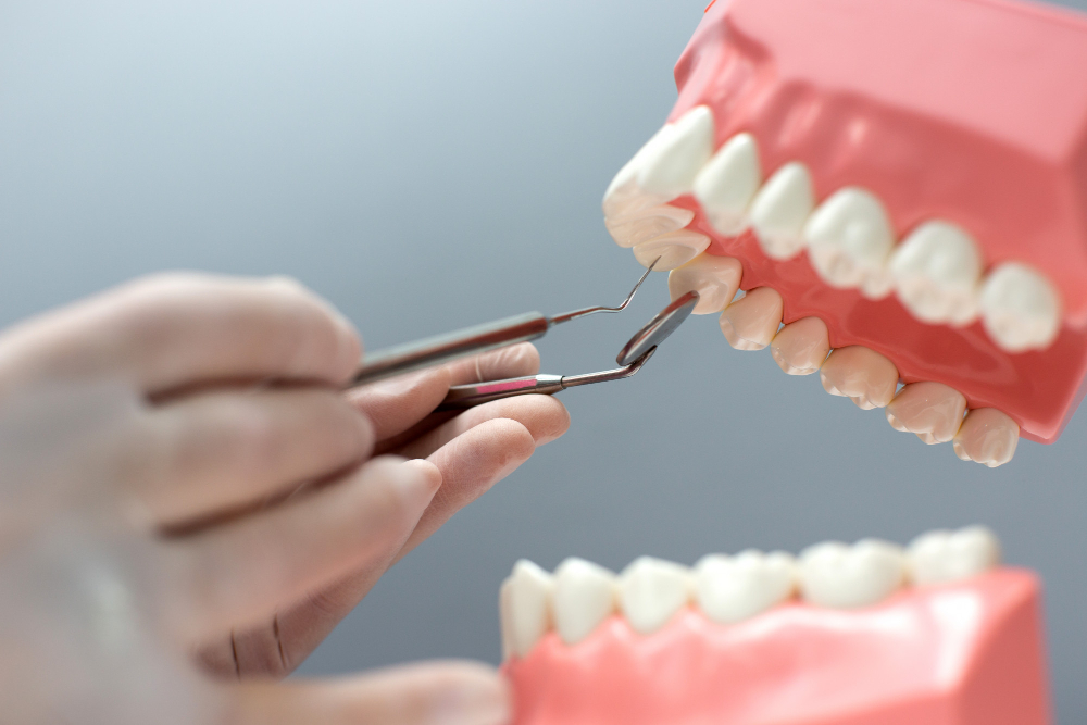 Rediscover Your Smile with Dentures at Gentle Care Family Dental