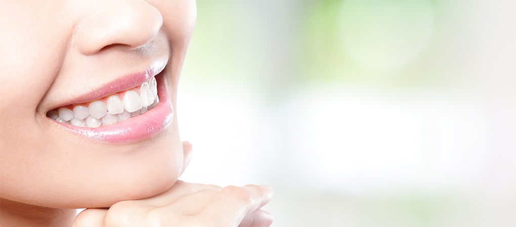 Teeth Whitening