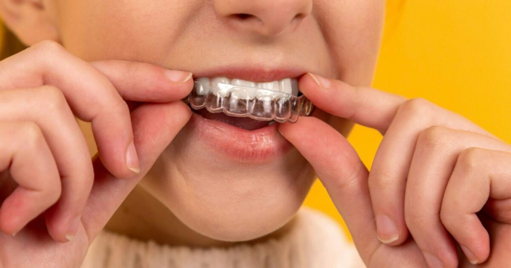 Transform Your Smile with Invisalign at Gentle Care Family Dental
